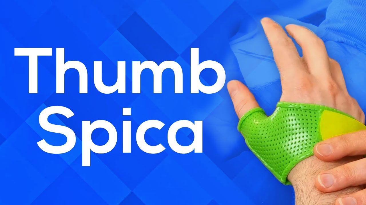 How To Make A Thumb Spica Splint within Hand Based Thumb Spica Splint Pattern Printable
