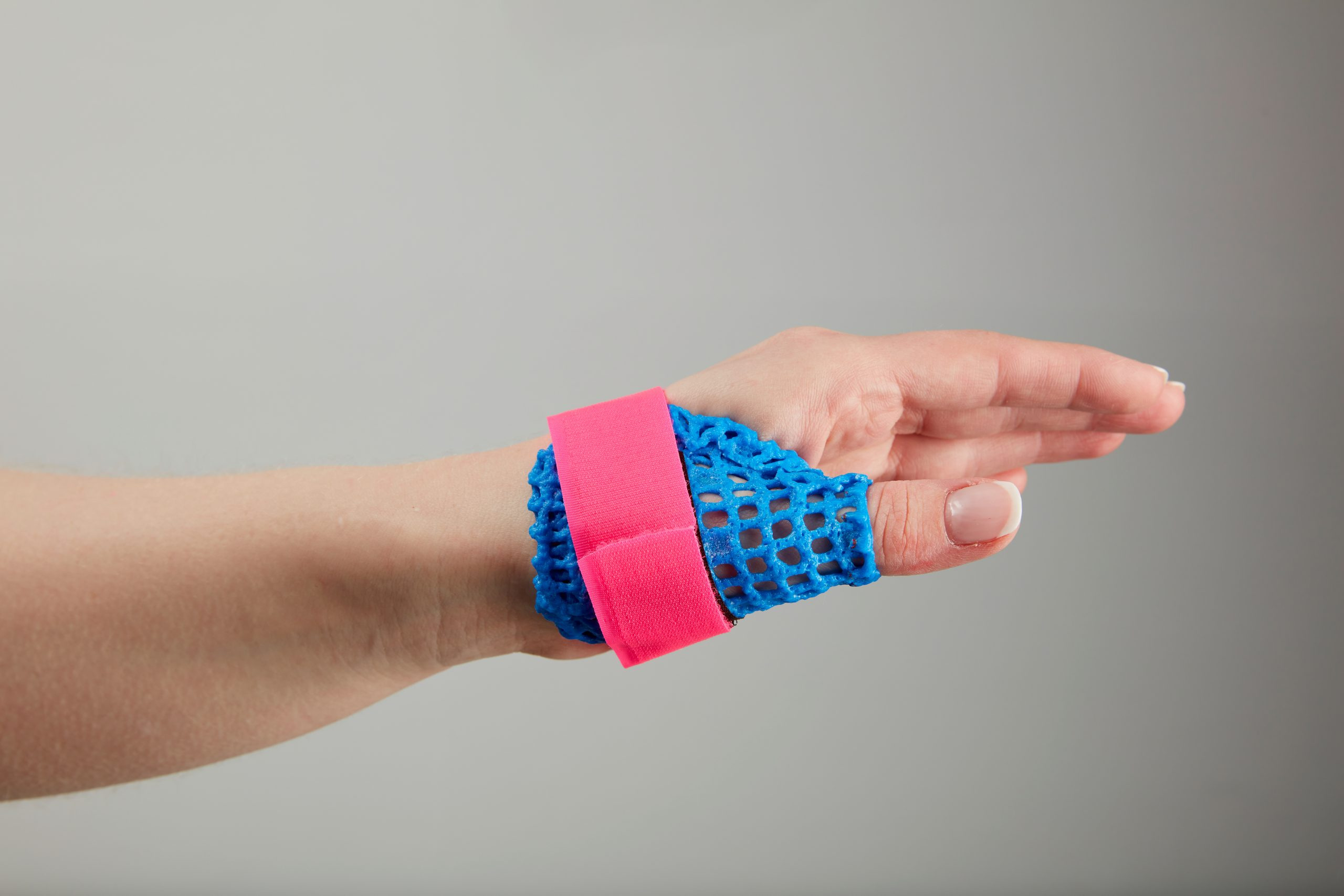 X-Lite® Splint Templates | Kinetec Uk with Printable Thumb Spica Splint Pattern