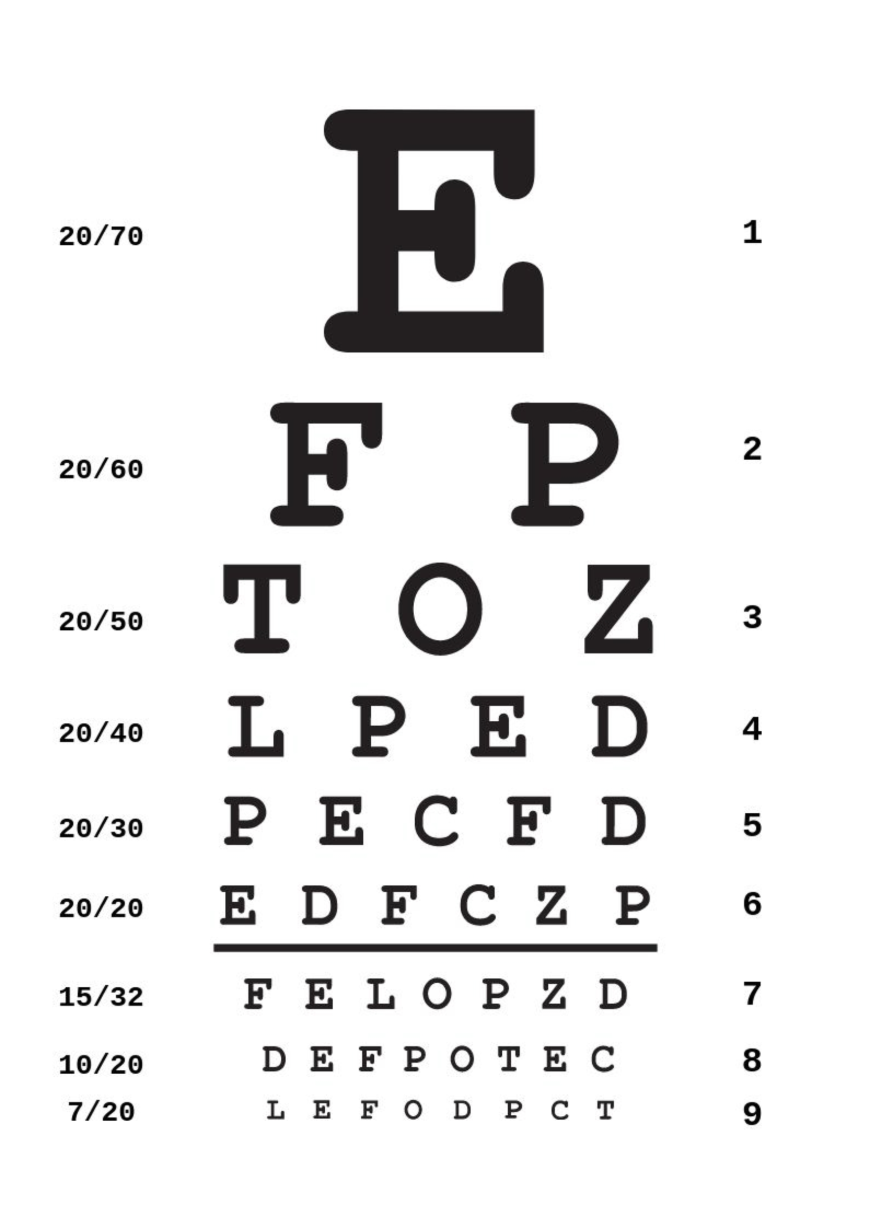Eye